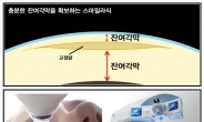 라식/라섹 받지 못하는 초고도근시 환자, 해결방안은?