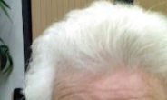 흰머리 원인, ‘새치와는 다르다’…최고의 예방법은?