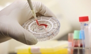 영국 옥스퍼드대, 새 에볼라 백신 인체 접종 개시…올해 중반 에볼라 창궐지역에 백신 공급하는게 목표