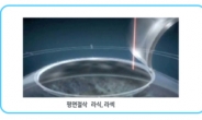 3D 스마일의 첨단기술, 라식에 이어 노안, 난시까지 개선 가능