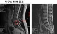 잠잠했던 박원순 아들 병역논란, 재점화 “MRI 공개”