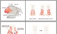 비중격만곡증 바로잡고 휜코 해결!