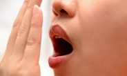 [입냄새 만드는 편도선염 ①] 방치하면 발생하는 염증, 입냄새 원인 돼요