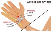 [추석 뒤 손 저림 ①] ‘손목이 시큰’ 손바닥도 저리면 손목터널증후군