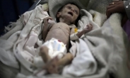 생후 1개월만에 영양 실조 사망…시리아 아기 생전 모습 ‘경악’