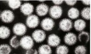 태안 집단 식중독 초등생 14명서 노로바이러스 검출