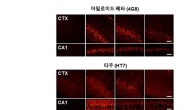 국내연구진 “브로콜리의 치매예방 가능성 제시”