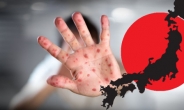 일본 ‘풍진 주의보’…임신부 여행자제·관광땐 예방접종 필수