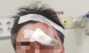 [단독]민주당 소속 구의원 ‘공무원 폭행’…경찰에 현행범 체포