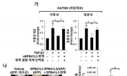 전이성 위암 발병 핵심인자 발견…신규 위암치료법 기대