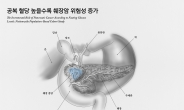 [김태열 기자의 생생건강] 당뇨없는 정상인도 ‘공복 혈당 높을수록’ 췌장암 위험성 증가