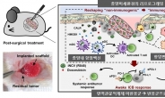 치료효율↑ 면역억제세포 약물전달체 개발