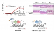 장(腸) 염증반응 막고 상처회복 촉진 기전 규명…장질환 새 치료제 개발 기대