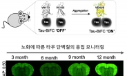 치매 초기부터 모니터링 가능해진다…신규 치매 플랫폼 개발