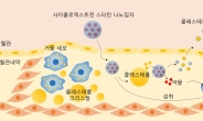 나노 약물전달체로 동맥경화증 치료효과↑…심혈관질환 정복 기대