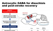 뇌졸중 후유증 치료길 열렸다…‘기능해리’ 발생기전 규명