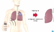 몸속에서 스스로 없어지는 ‘전자의료기기’…약물 부작용 낮춘다