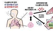 환경파괴 주범 ‘미세 나노플라스틱’…폐 세포도 없앤다