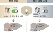 惱 통증조절 시스템 오작동…만성 신경병성 통증 유발한다