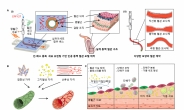 CT·MRI 없이도 동맥경화 살핀다…포스텍 ‘인공동맥혈관’ 개발