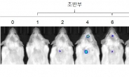 우울증 유발 과정 파악…치료길 열린다!