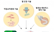 혈관‧신경조직 재생시키는 ‘맞춤형 인공근육’ 나왔다