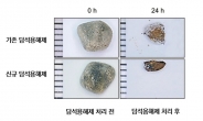 담낭 절제수술없이 담석만 골라 없앤다!