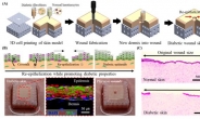 3D프린팅으로 ‘인공피부’ 개발…피부질환 관찰 동물실험 대체한다