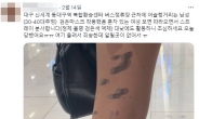 동대구역서 女 다리에 ‘검은 액체’ 테러…강남역 ‘먹물테러’ 재현?