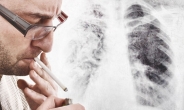 “흡연자 폐암발생률 22배 높아…흡연ㆍ폐암 인과관계 분명”
