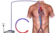 “폐 이식 앞둔 젊은 환자에 효과적”…흉부외과학회 에크모 가이드라인 발표