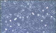 바이오스타줄기세포硏, ‘소변줄기세포’ 분리·배양기술 개발