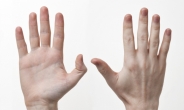 손바닥이 불긋불긋?…손으로 보는 건강신호 6가지