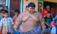 10살에 무려 192kg…세계 최고 비만아 사연