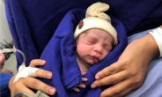 사망한 여성 자궁 이식받은 산모, 세계 최초로 출산