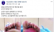 '40km 완전군장 행군' 군인의 발 온라인서 화제