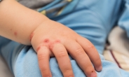 백신 없는 수족구병…3월 등원 유치원·어린이집 ‘비상’