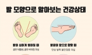 [김태열의 생생건강S펜]  누웠을 때 발 사이 벌어지면 ‘골반’, 발끝이 앞으로 향하면 ‘발목’ 문제
