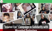 이란 보안군, 女 시위자 얼굴 가슴에 산탄총 쏘는 심리는...?