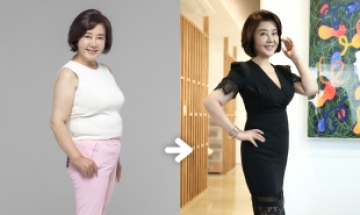 10kg 다이어트 성공한 김영란, 67세에 이런 핏이 가능?