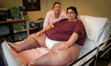 “너무 뚱뚱해서”…318kg 英 남성, 사망 후 장례식 못 치러