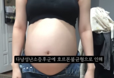‘임신 36주 낙태’ 유튜버, 동영상 다 내렸다…의사들 “가짜여도 강력 처벌”