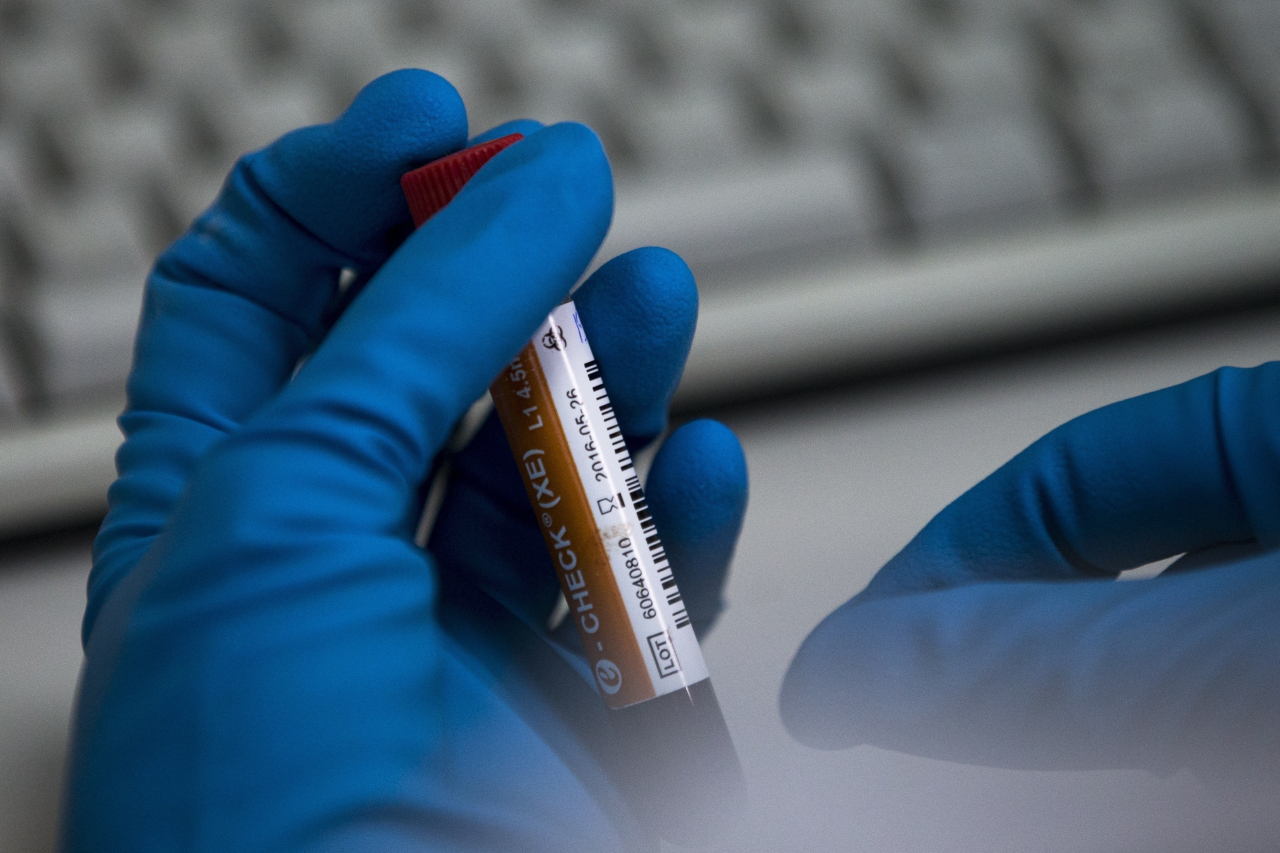 In this May 24, 2016 file photo an employee of the Russia's national drug-testing laboratory holds a vial in Moscow, Russia. Russia is accused of manipulating an archive of doping data from a laboratory in Moscow, which was meant to be a peace offering to the World Anti-Doping Agency to solve earlier disputes. (AP-Yonhap)