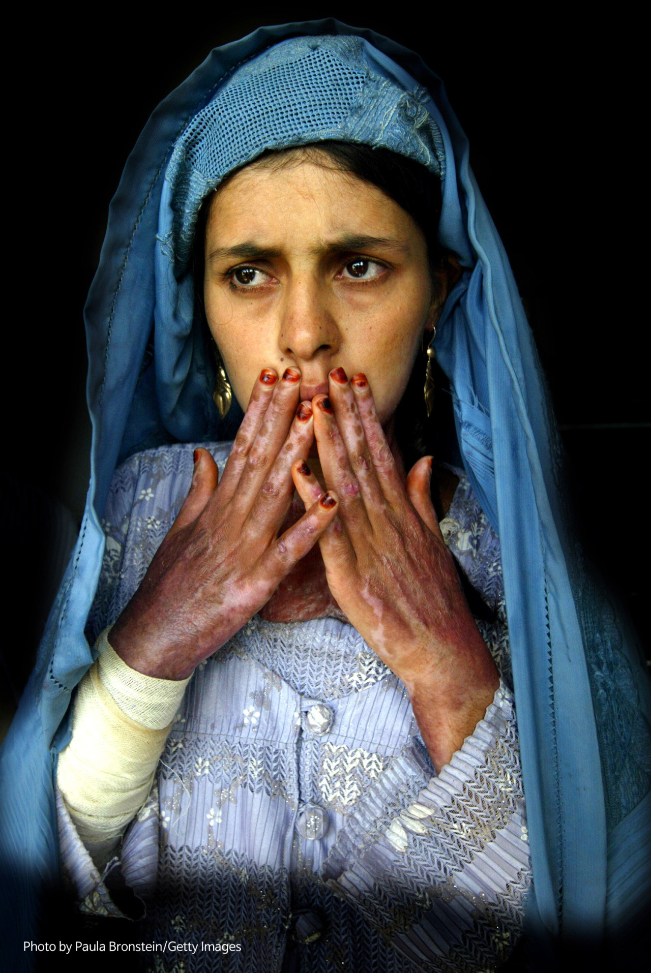 “Desperation Drives Women to Self Immolation in Herat” by Paula Bronstein (Getty Images)