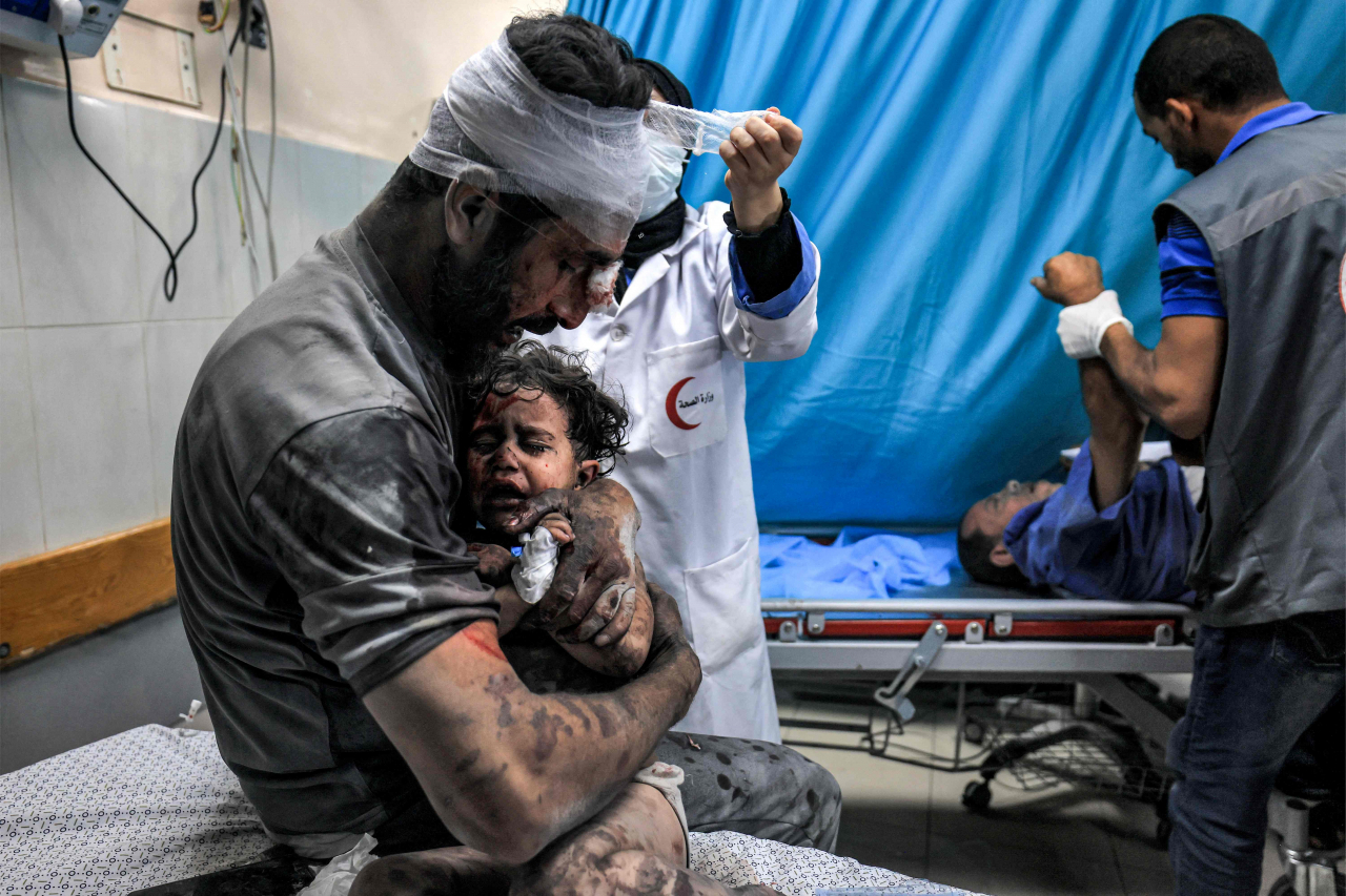 An injured man holds an injured child, both survivors of Israeli bombardment, while a nurse bandages his head at a trauma ward at Nasser hospital in Khan Yunis in the southern Gaza Strip on Tuesday. (AFP-Yonhap)