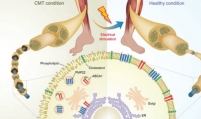 Scientists develop world's first Charcot-Marie-Tooth therapy