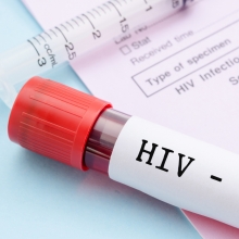 Refusal of surgery for HIV patient discriminatory: NHRC