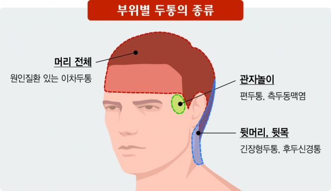 두통 부위별 원인과 증상을 알아보고, 그에 맞는 약을 처방하세요!