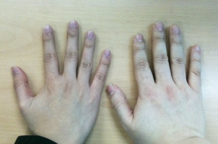 Length of ring finger related to men's attractiveness