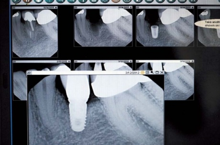 More people take longer-lasting options to replace missing teeth